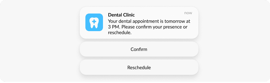 Rich push notification with interactive elements